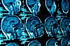 POPULÆR E-TJENESTE: Både heldøgnsbrukere og personer som skal i avlastning formidles via kommunenes åpne anbudsutlysninger på nett. (Bilde av MRI-scanning)